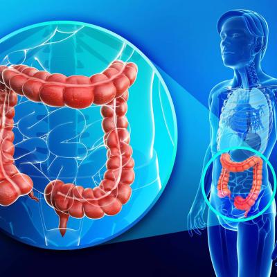 RICORRENTI INFIAMMAZIONI E DISTURBI INTESTINALI? PROVA COL DOSAGGIO DELLA CALPROTECTINA FECALE!